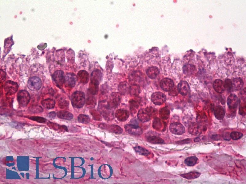 IHC-plus™ ZNF217 Antibody (aa604-617)