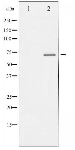 ER Alpha / Estrogen Receptor Antibody (phospho-Ser106)