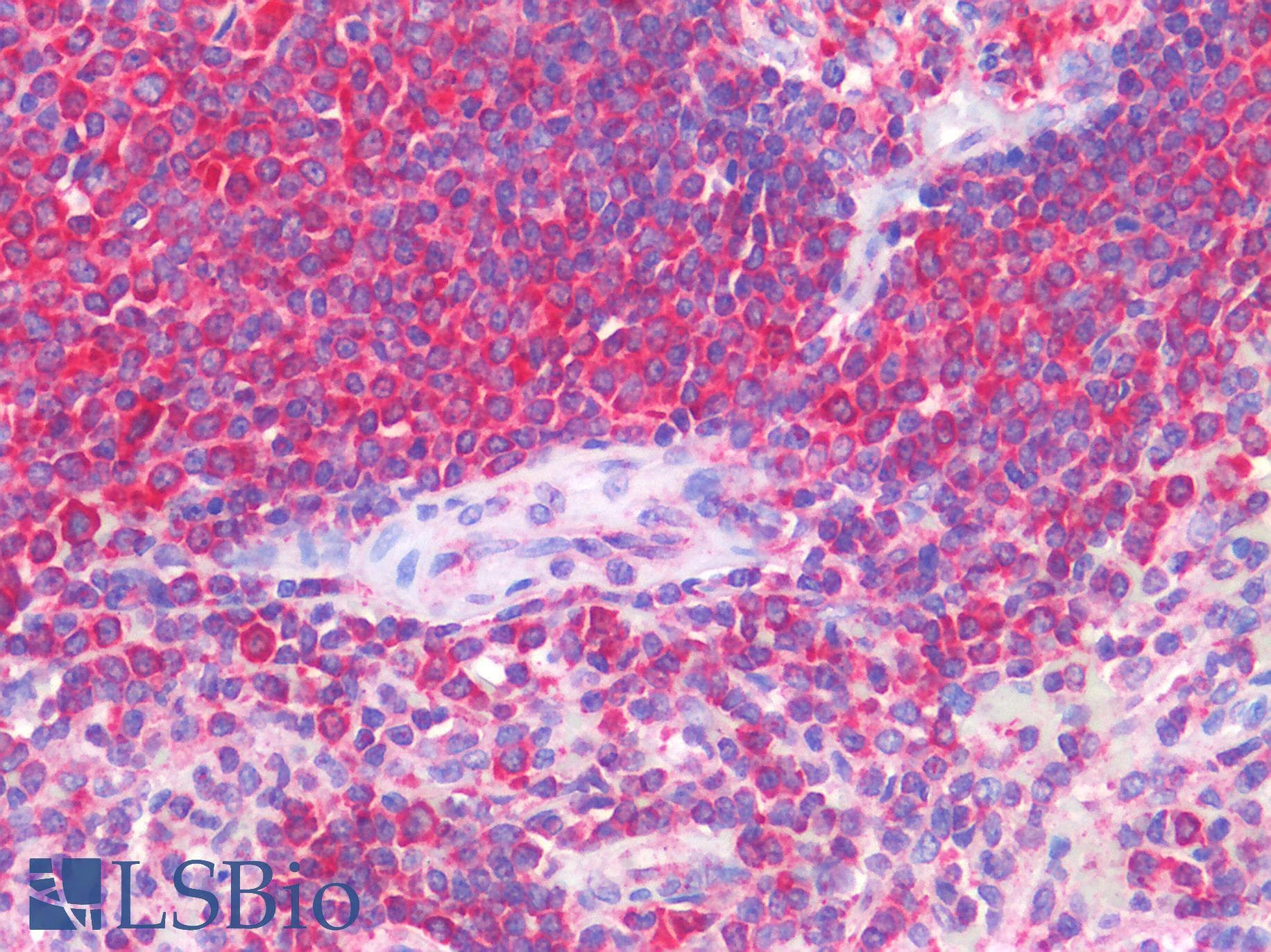 IHC-plus™ IL-1B / IL-1 Beta Antibody