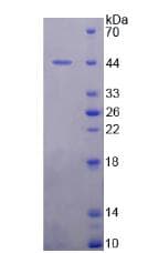 Human MDM2 Protein (Recombinant His, N-Terminal)