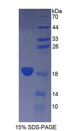 Mouse CD164 Protein (Recombinant His-T7)