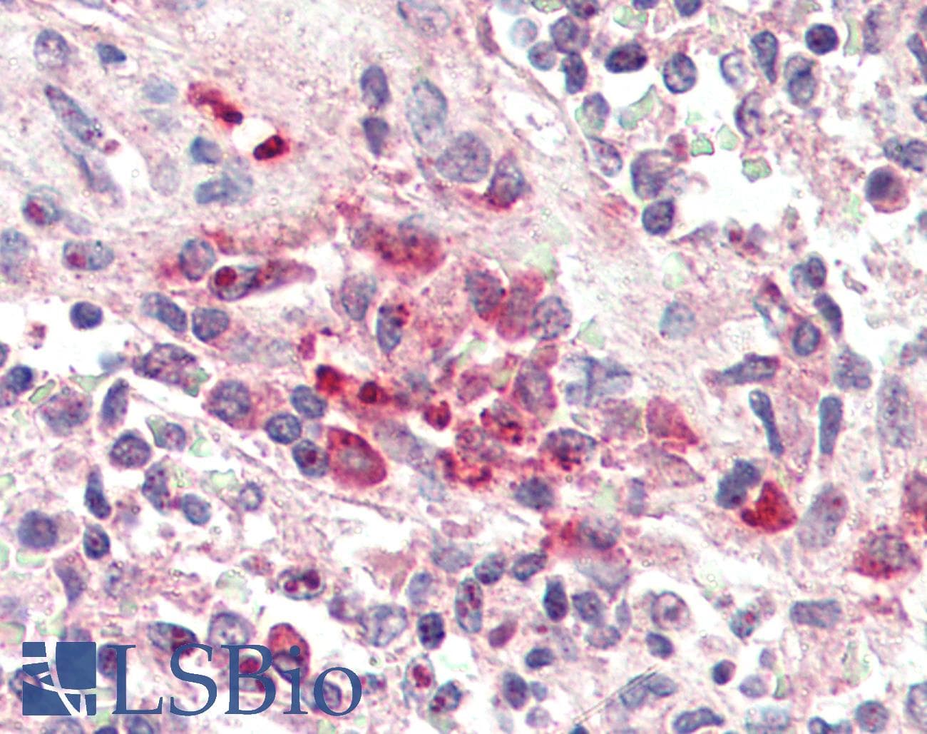IHC-plus™ TREM2 / TREM-2 Antibody (aa199-212)