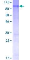 Human WEE1 Protein (Recombinant GST)
