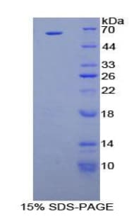 Human HGF / Hepatocyte Growth Factor Protein (Recombinant GST)