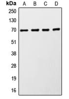 RPS6KB1 / P70S6K / S6K Antibody (C-Terminus)