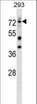 NUDR / DEAF1 Antibody (aa474-502)