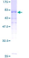 Human PPP2R2A Protein (Recombinant GST)