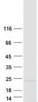 Human CPLX2 / Complexin 2 Protein (Recombinant Myc-DDK (Flag))