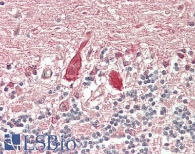 IHC-plus™ BAIAP2 / IRSP53 Antibody