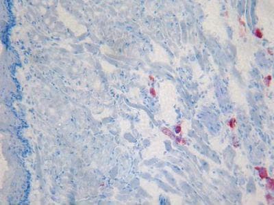c-Kit / CD117 Antibody (clone ACK4)