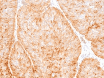 SLC2A1 / GLUT-1 Antibody (clone GLUT1/2475)