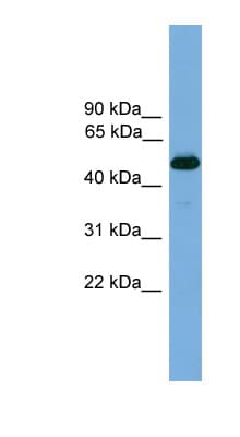 Polyclonal Rabbit anti-Mouse NR1A2 / THRB Antibody (N-Terminus, WB)