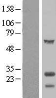 TPPP Protein (Over-Expression Lysate Myc-DDK (Flag))