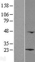 LZIC Protein (Over-Expression Lysate Myc-DDK (Flag))