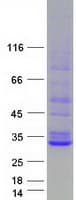 Human STAR Protein (Recombinant Myc-DDK (Flag))