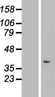 TAF1D Protein (Over-Expression Lysate Myc-DDK (Flag))