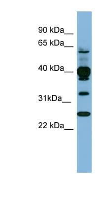 Polyclonal Rabbit anti-Human PLEK / Pleckstrin Antibody (N-Terminus, WB)