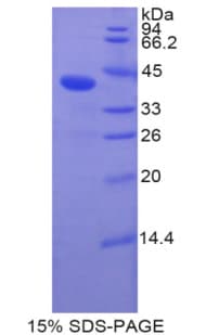 Human BMP10 Protein (Recombinant His-GST)