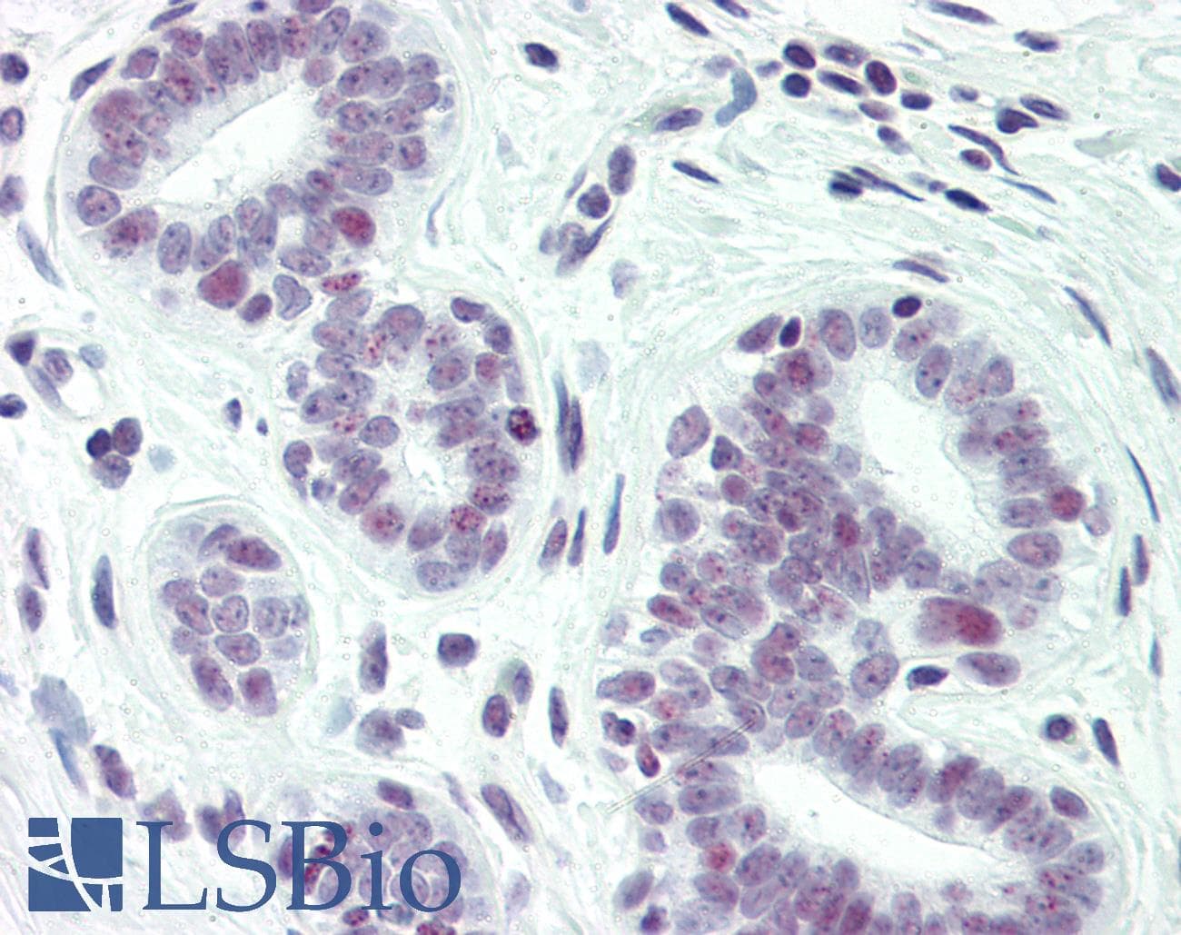IHC-plus™ Polyclonal Rabbit anti-Human PAX2 Antibody (phospho-Ser393, IHC, WB)