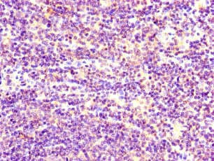 Polyclonal Rabbit anti-Human GOK / STIM1 Antibody (IHC)