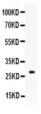 Polyclonal Rabbit anti-Human KLK8 / Kallikrein 8 Antibody (WB)