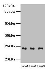 Polyclonal Rabbit anti-Human RAB4B Antibody