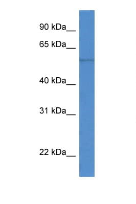 RCC2 Antibody (aa108-157)