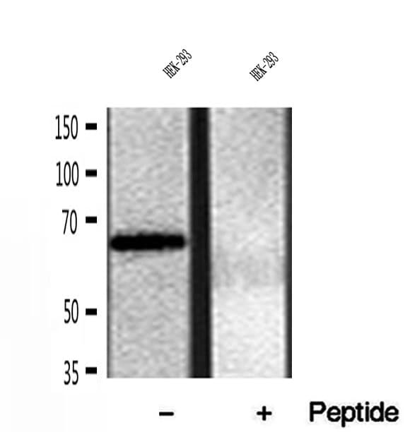 Polyclonal Rabbit anti-Human FKBP10 / FKBP65 Antibody (IHC, WB)