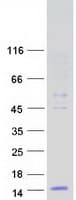 Human DEFB124 Protein (Recombinant Myc-DDK (Flag))
