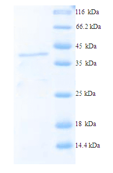 Human ADAMTS7 Protein (Recombinant His)