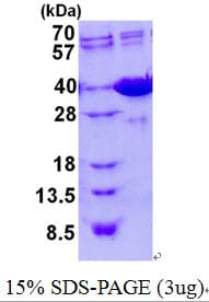Mouse GAL4 / Galectin 4 Protein (Recombinant His)