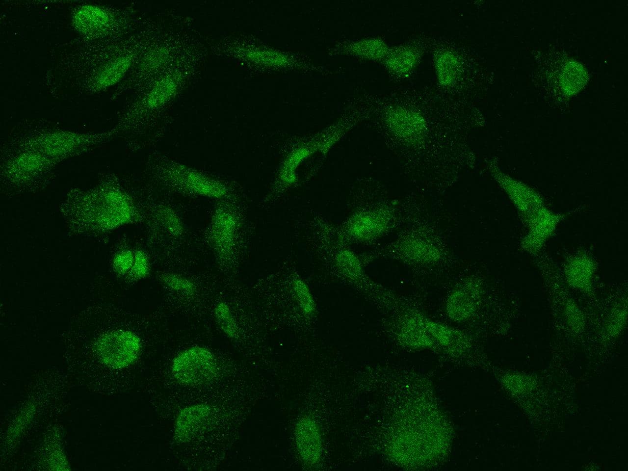 RPS6KA5 / MSK1 Antibody