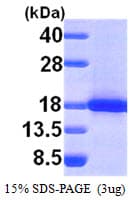 Human SH2D1A / SAP Protein (Recombinant His)
