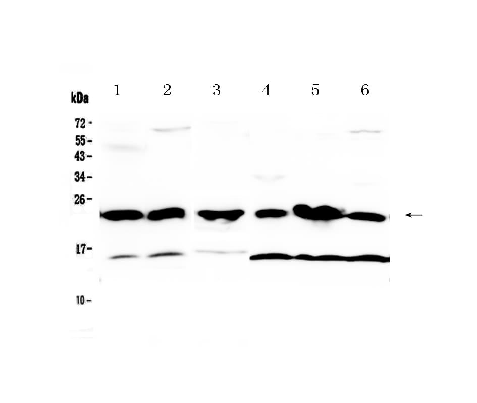 Polyclonal Rabbit anti-Mouse GSTP1 / GST Pi Antibody (IHC, WB)