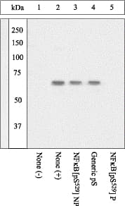 RELA / NFKB p65 Antibody (phospho-Ser529)