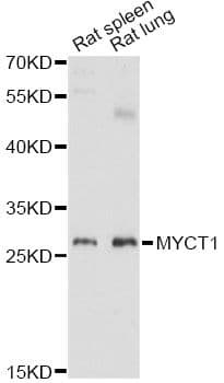 Polyclonal Rabbit anti-Human MYCT1 Antibody (WB)