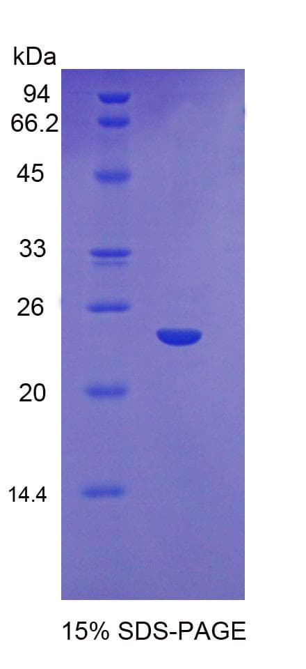Mouse GSS / Glutathione Synthetase Protein (Recombinant His)