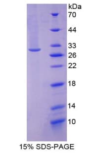 Rat ITGA1/CD49a/Integrin Alpha 1 Protein (Recombinant His-T7)