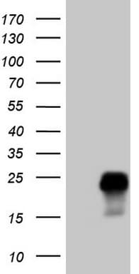 TCAP / Telethonin Antibody (clone OTI8E6)