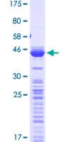 Human TPT1 / TCTP Protein (Recombinant GST)