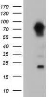 MTMR14 Antibody (clone OTI9G9)
