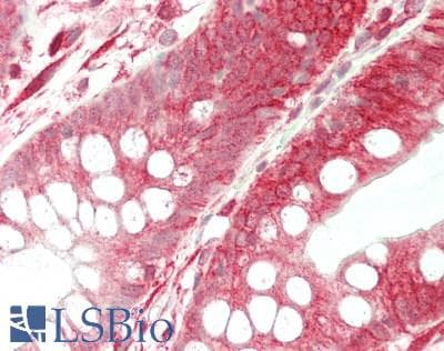 IHC-plus™ SEPT9 / Septin 9 Antibody