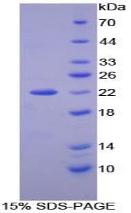 Human NXN Protein (Recombinant His-T7)