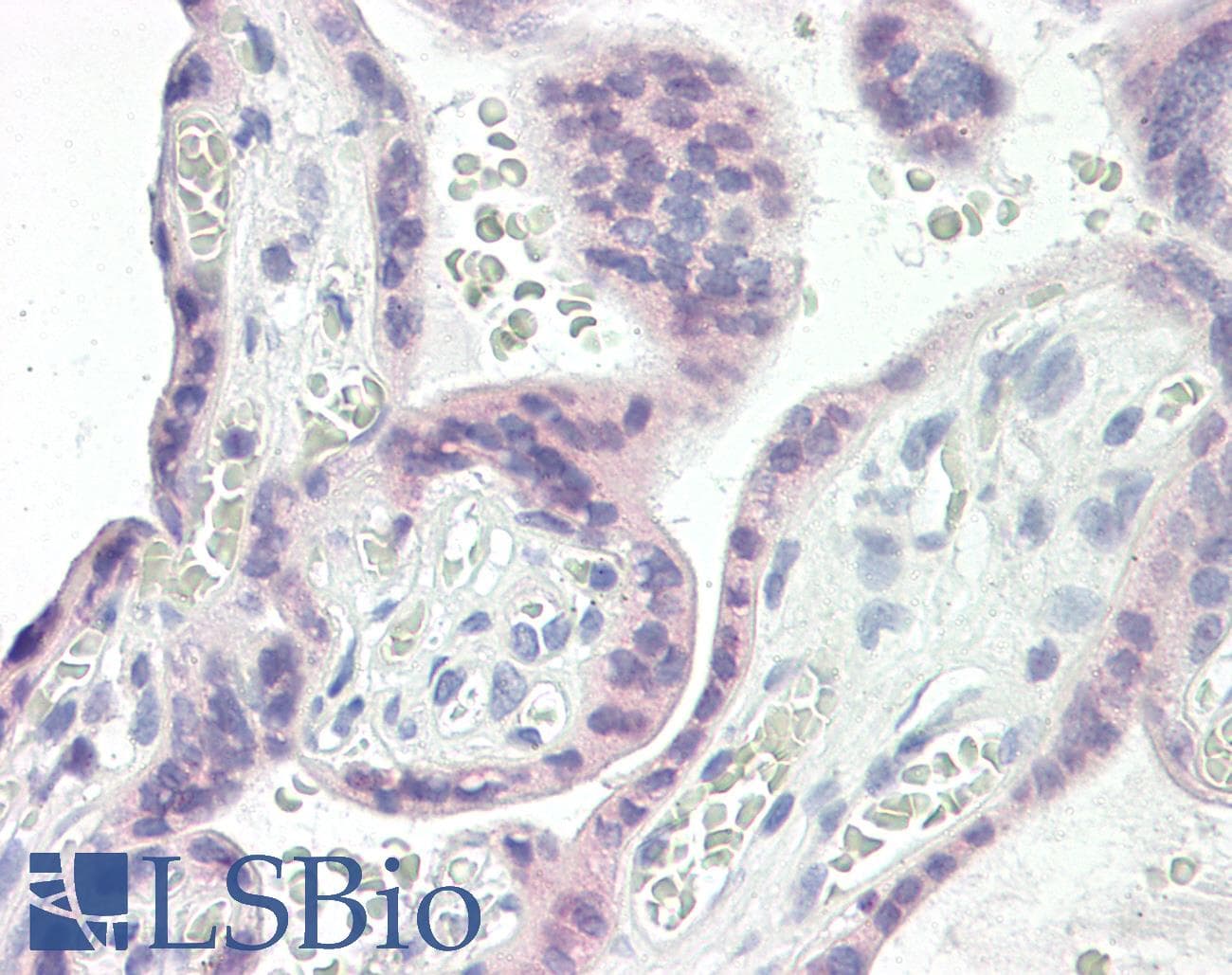 IHC-plus™ Polyclonal Rabbit anti-Human ARAF / ARAF1 / A-RAF Antibody (aa276-325, IHC, WB)
