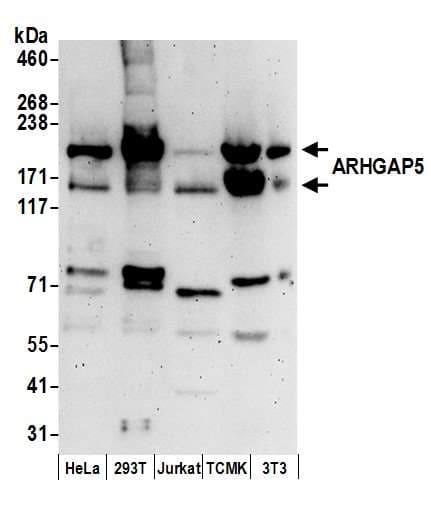 Polyclonal Rabbit anti-Human ARHGAP5 / RhoGAP5 Antibody (aa1050-1100, WB)
