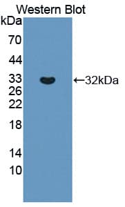 ABCC8 / SUR1 Antibody (aa679-929, APC)