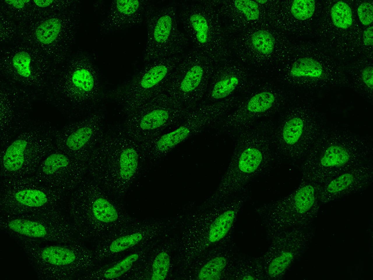 Polyclonal Rabbit anti-Human SATB2 Antibody (IF)
