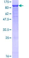 Human NRP1 / Neuropilin 1 Protein (Recombinant GST)