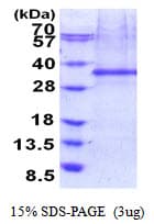 Human FHL2 Protein (Recombinant His)