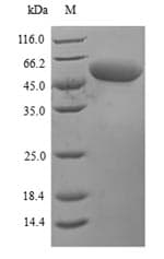 Mouse PRF1 / Perforin Protein (Recombinant 6His, N-terminus)